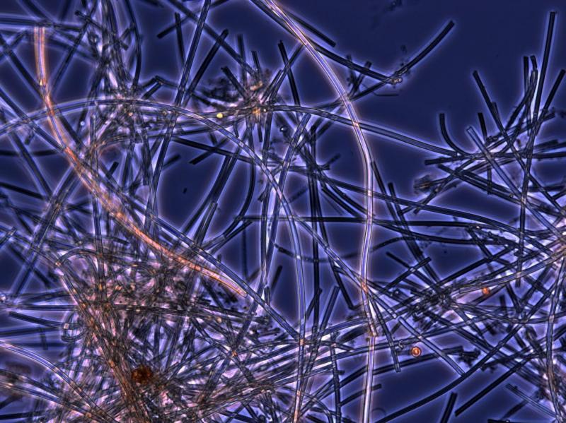 Iron-oxidizing bacteria live in environments as extreme as the deep ocean and as common as roadside ditches. A recent paper in Frontiers proposes distributing the iron these bacteria naturally produce to “fertilize” phytoplankton and help remove excess carbon dioxide from the atmosphere. Courtesy of Bigelow Laboratory for Ocean Sciences