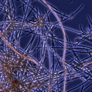 Iron-oxidizing bacteria live in environments as extreme as the deep ocean and as common as roadside ditches. A recent paper in Frontiers proposes distributing the iron these bacteria naturally produce to “fertilize” phytoplankton and help remove excess carbon dioxide from the atmosphere. Courtesy of Bigelow Laboratory for Ocean Sciences